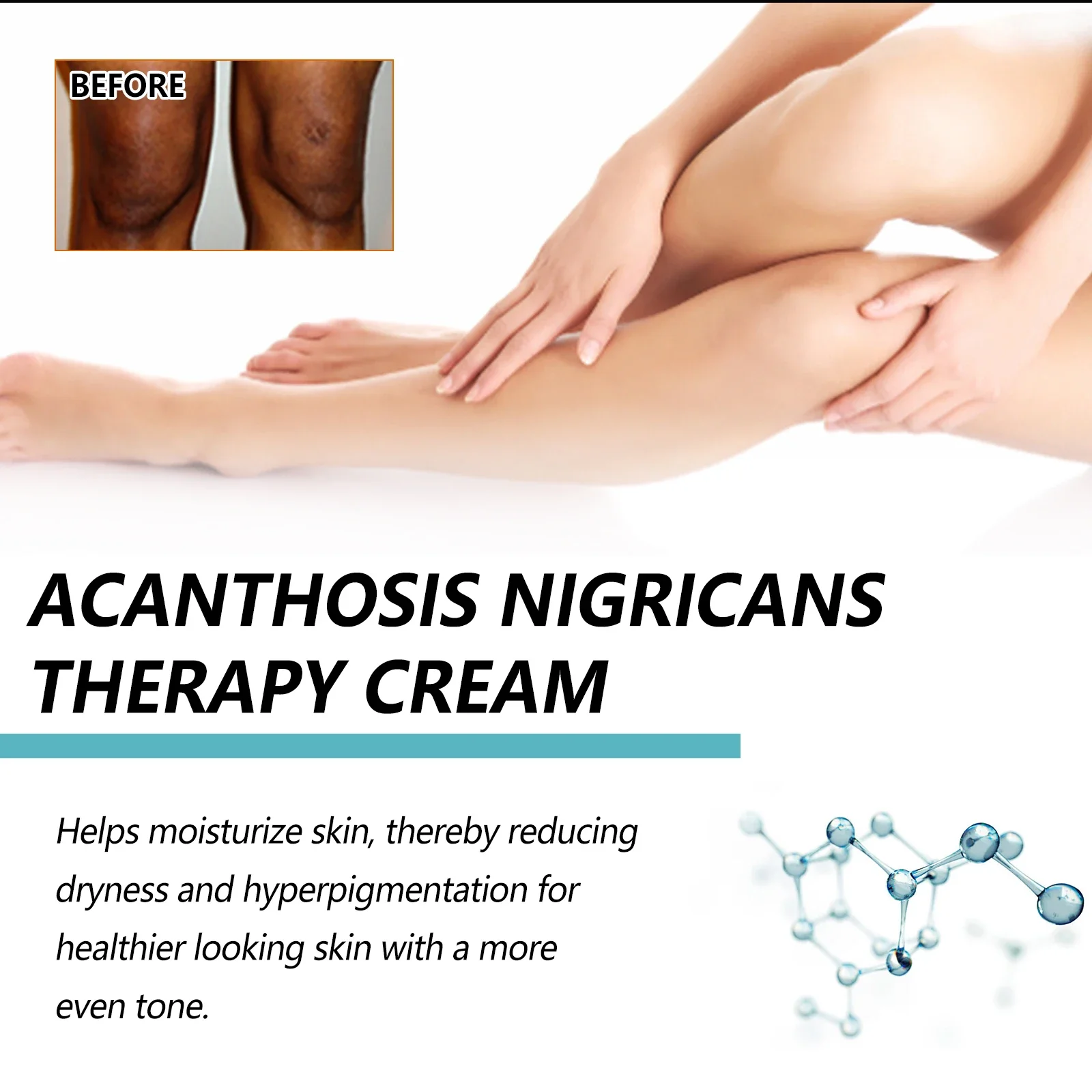 Black Acanthoderma Moisturizing Repair Cream Brightening Armpits Arms Knees Lightening Emulsion Brighten Skin Body Care Cream 4