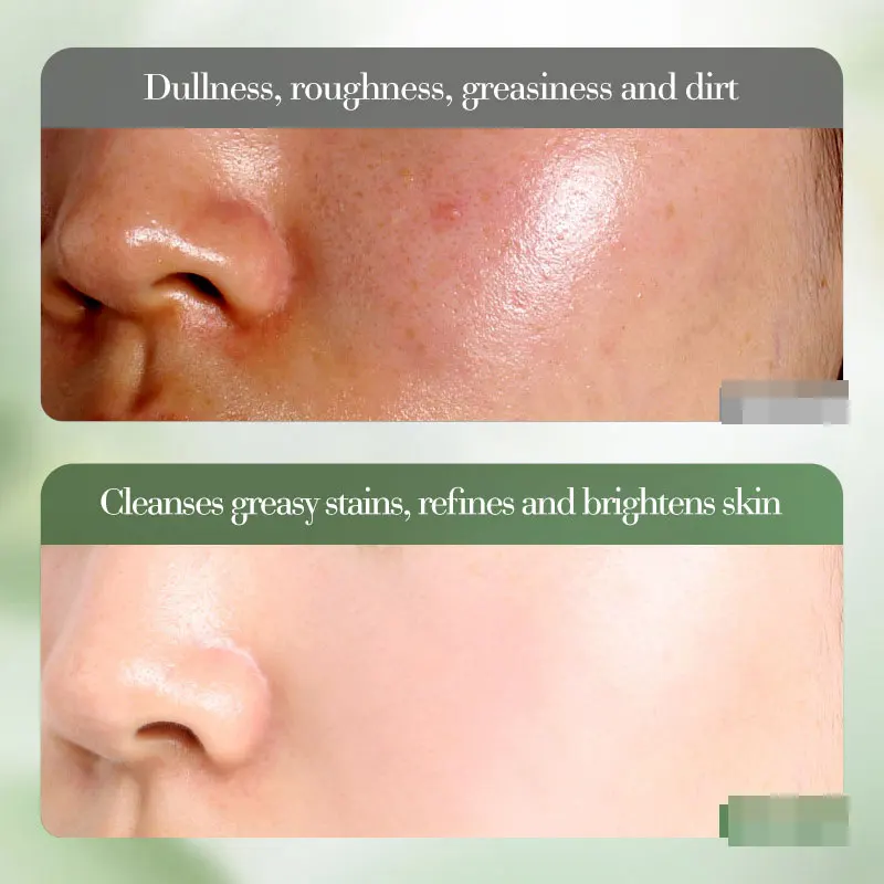 Vitamin C Whitening and Brightening Cleanser Cleansing and Blackhead Removal Deep Cleansing Oil Control Cleansing Products