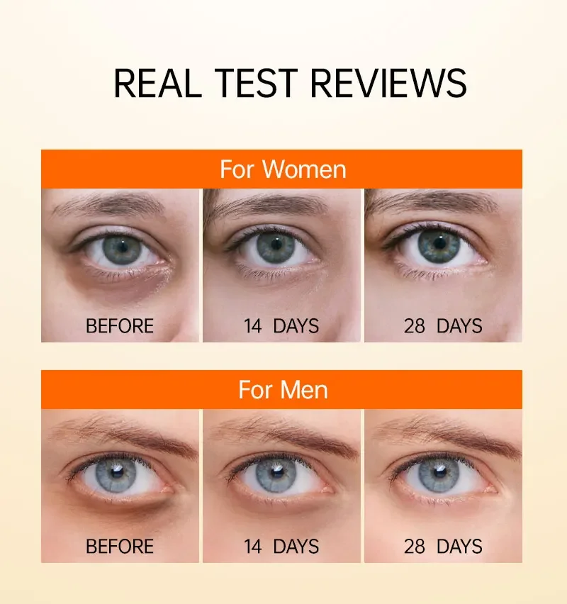 Brightening Vitamin C Eye Cream for Dark Circles