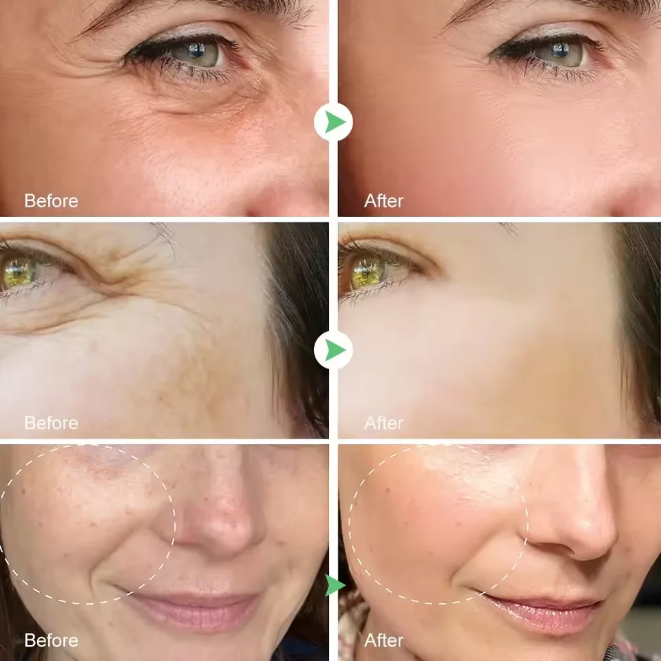 Retinol Remove Wrinkle Face Serum Lift Firming Anti Aging Fade Fine Lines Whitening Brightening Moisturizer Skin Care Cosmetics - Image 5