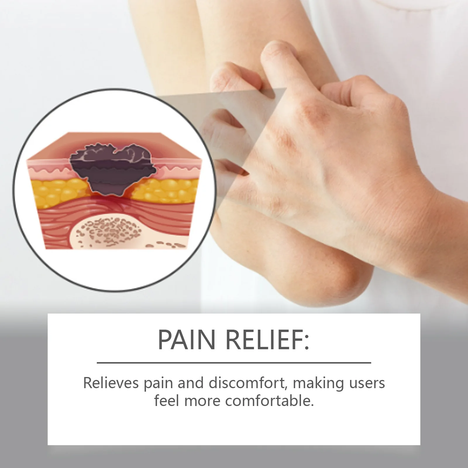 South Moon Bedsores Wound Healing Ointment Removal Rot Myogenic Pressure Sores Ulcer Festering Anti Infection Repair Skin Care