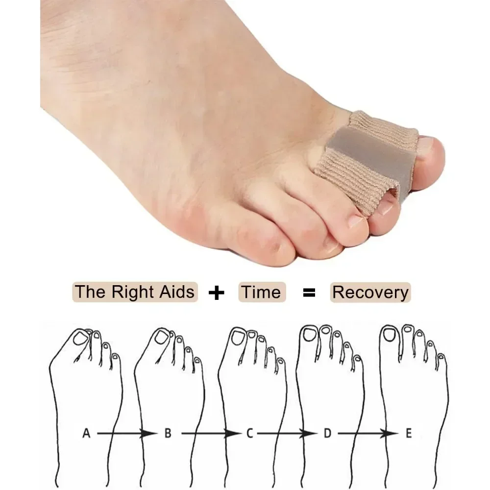 1/2Pc Two Toe Separator Hallux Valgus Bunion Corrector Orthotics Feet Thumb Adjuster