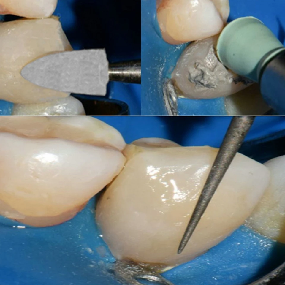 Punta In Silicone Lucidante - Lylly Nails - Foto 3