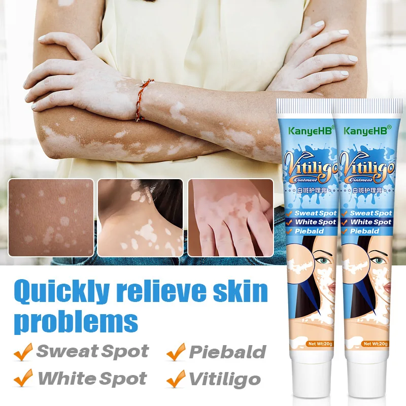 

White Spot Disease Cream Vitiligo Ointment Treament Repair Leukoplakia Reduce Pigment Melanin Antibacterial Moisturing Skin Care