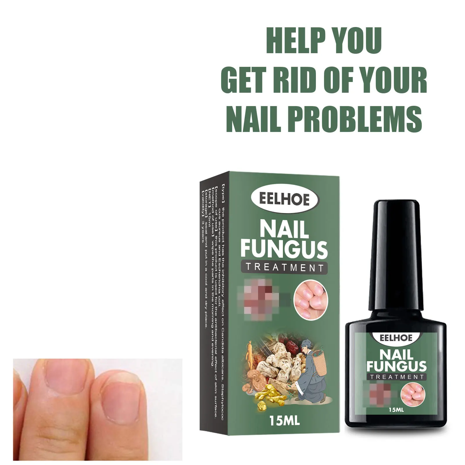 Nail Fungal Treatment Essence Oil Foot Toe Nail Fungus Removal Serum  Repair Onychomycosi Anti Infection Gel Care Products