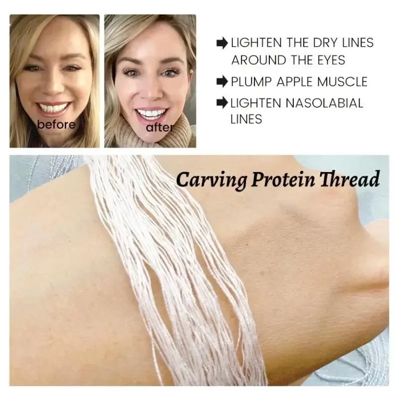 Radar Thread No Needle Silk Fibroin Line Carving Essence Collagen Facial Thread Lift Anti Aging Hyaluronic Tightening Skin Care