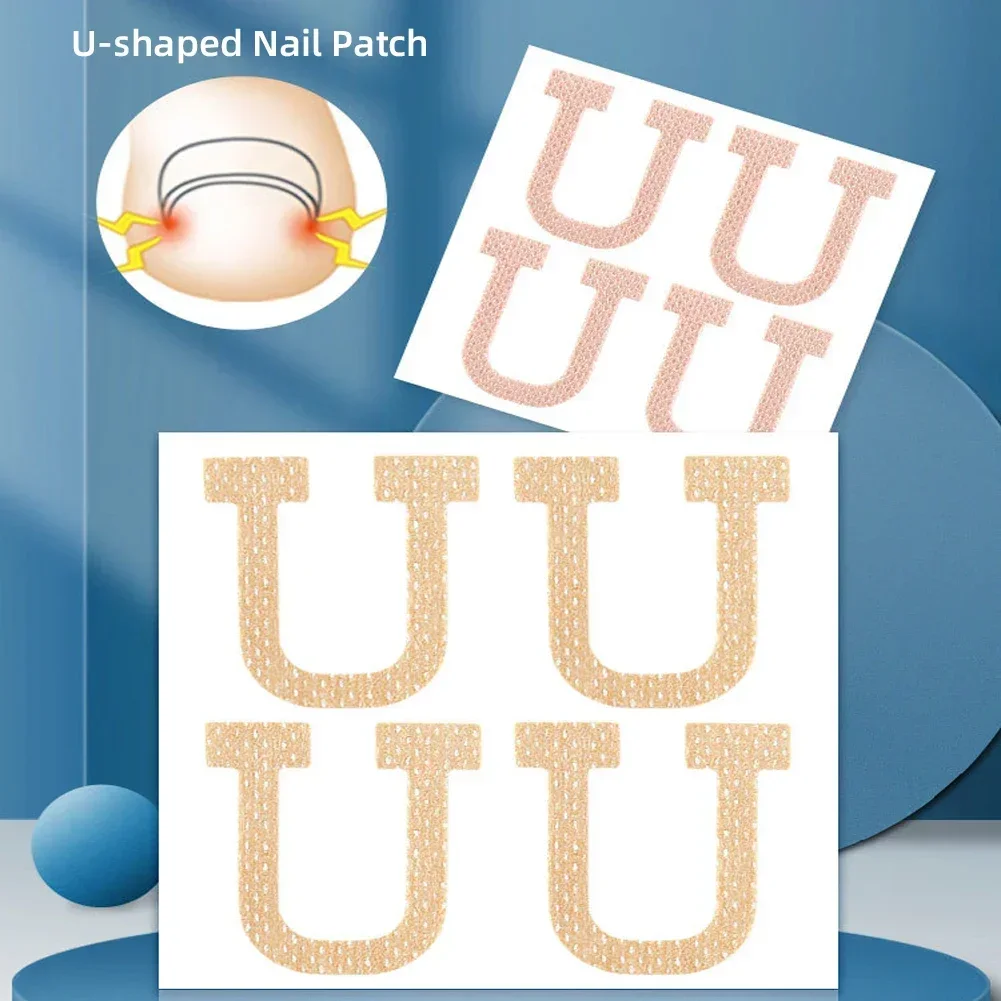 Nail Correction Stickers Ingrown Toenail Corrector Patches Treatment Recover Corrector Pedicure Care Tool 4Pcs/Sheet