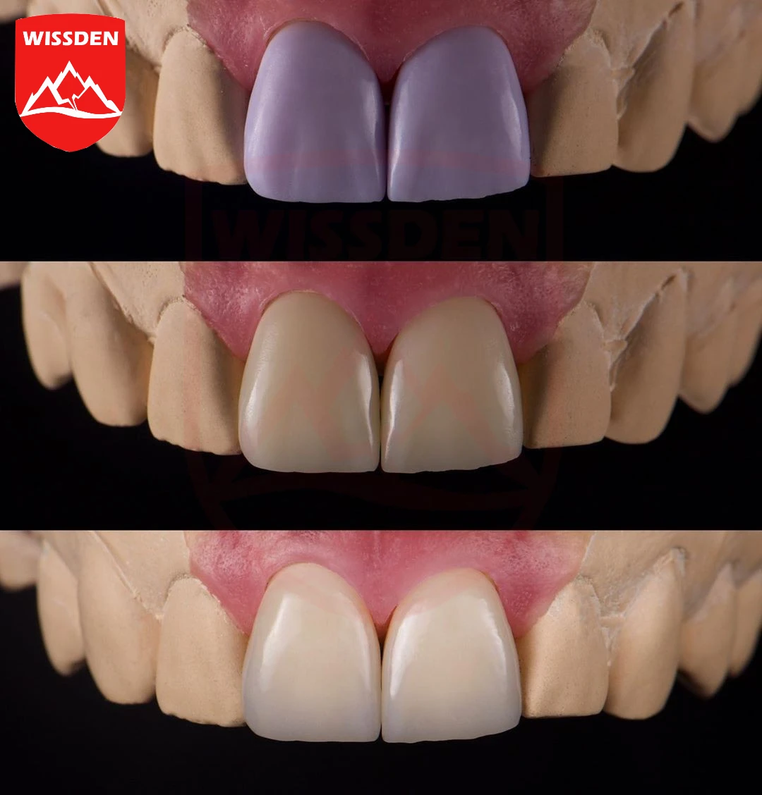 5 Pieces C14 Lithium Disilicate Blocks Cerec emax CAD Wissden Dental Glass Ceramic Cubes HT/LT CAD/CAM Manufacturer 3