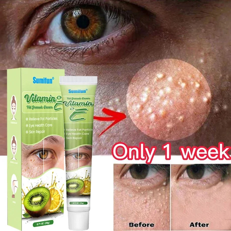 pure silver pellets ag slugs high purity 4n silver pellets granules particles Fat Granules Remover Eye Cream Effective Remove Fat Granules Puffiness Anti-Particles Milia Remover Product Repair Eye Skin Care