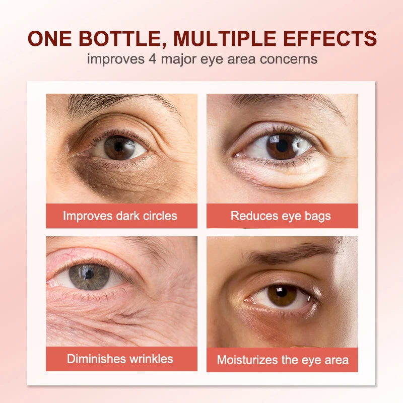 Auquest Anti Dark Circle Eye Cream with Peptides Eye Bag Contour Anti-Wrinkle Puffiness Lifting Firmness Massager Cosmetics Care