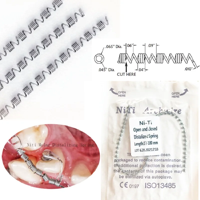 5Bags Ni ti Dental Orthodontic Open and Closed Distalized Spring 180mm