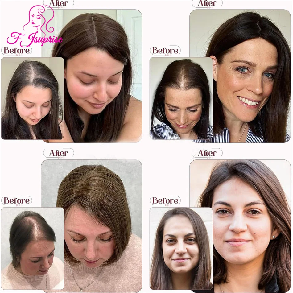 Silk Top Human Hair Closure 5x5 Silk Base Lace Closure Brazilian Straight Human Hair Closures Pre Plucked Natural Color Hairline