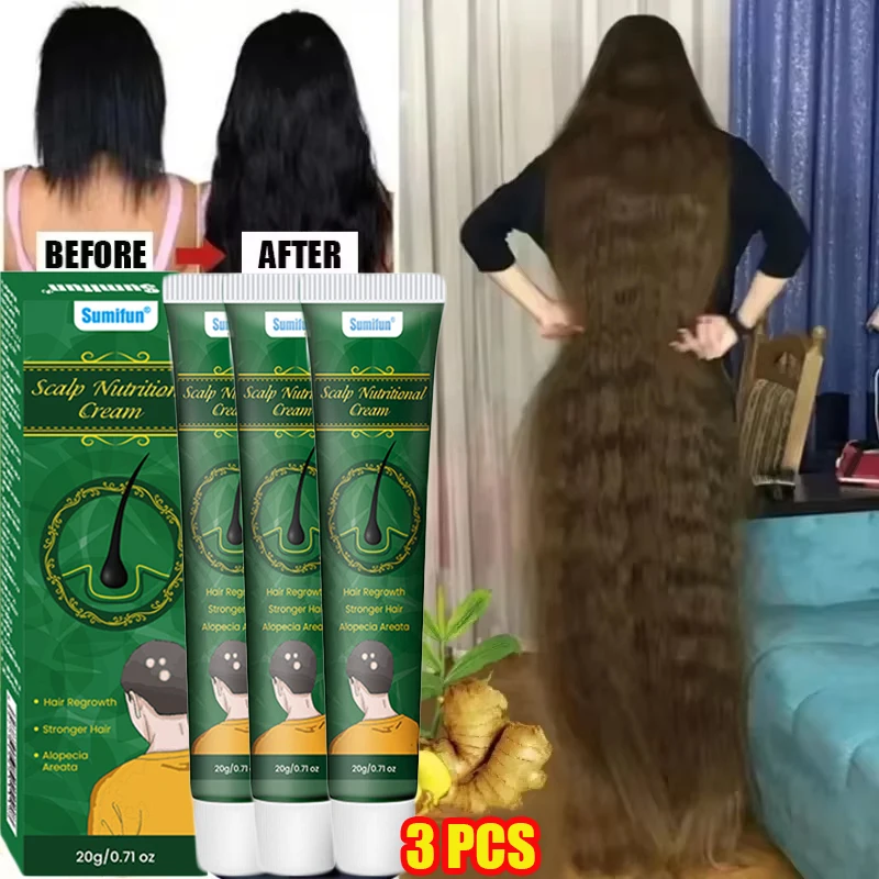 Ginger Hair Growth Cream Anti Hair Loss Baldness Repair Damaged Scalp Treatment Nourish Root Care Products Women Men
