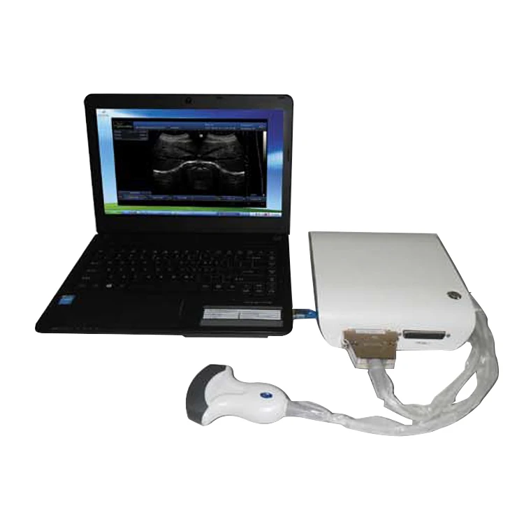 

ZT-BW-UB1 Medical Ophthalmic B Scan Ultrasound Machine Eye Equipment Ultrasound Box Scanner