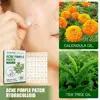 144patch Acne Pimple Patches Translucent Matte Hydrocolloid Salicylic Acid Tea Tree Oil For Inflamed Acne Improve Whiteheads 1