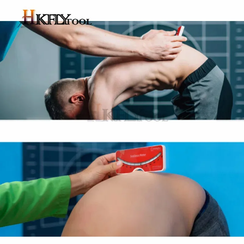 척추 및 척추 척추 측만증 진단을 위한 척추 측만증 의료 평가 측정 및 테스트 측정기 어린이 각도기