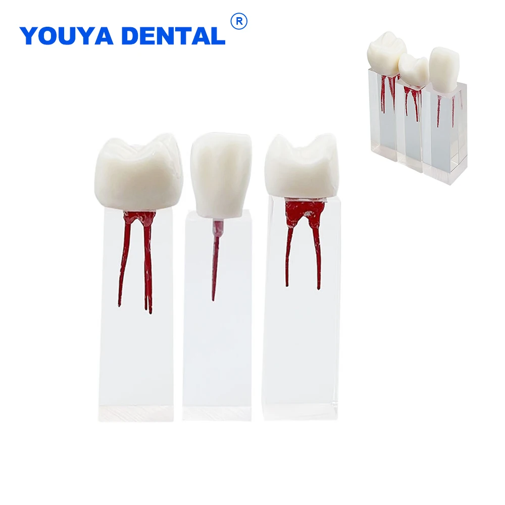 3Pcs Dental Model Endodontic Root Canal Resin Study Endo Training Tooth