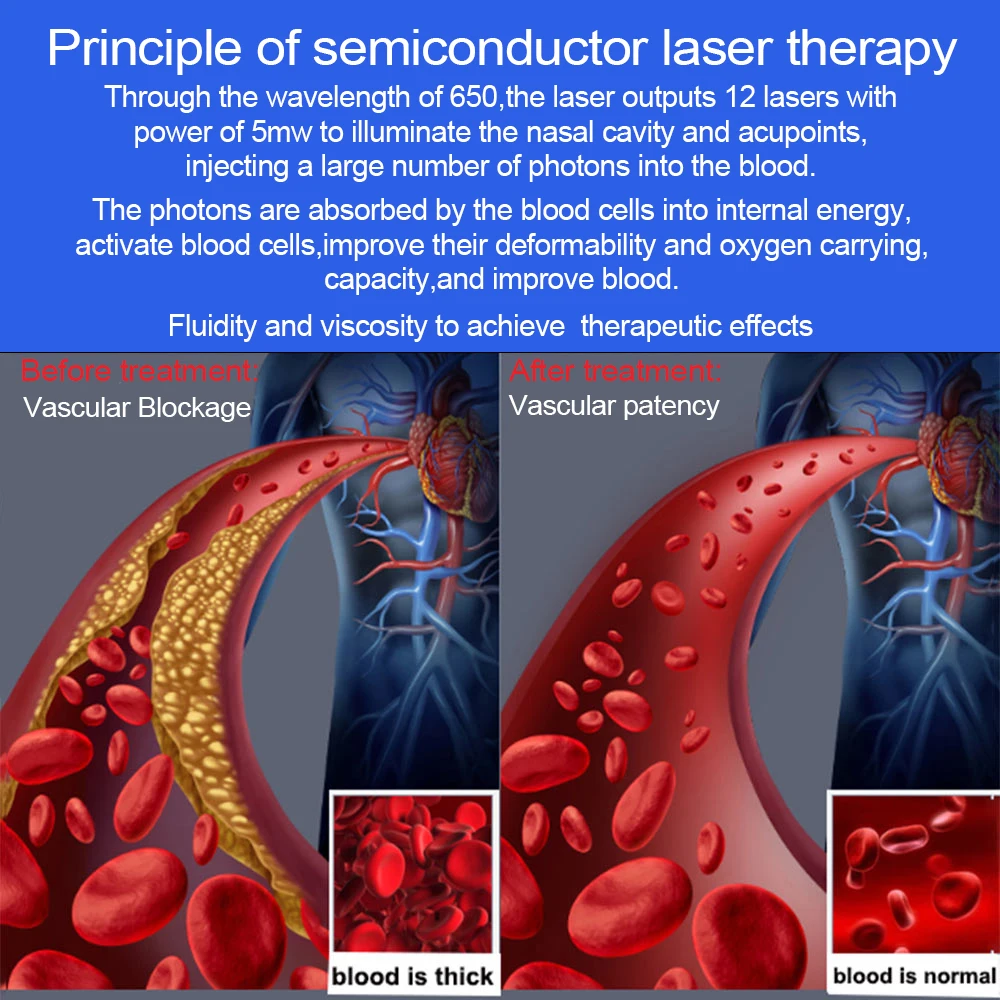 Advanced 650nm LLLT Laser Therapy Wrist Device for Professional Physiotherapy and Relaxation