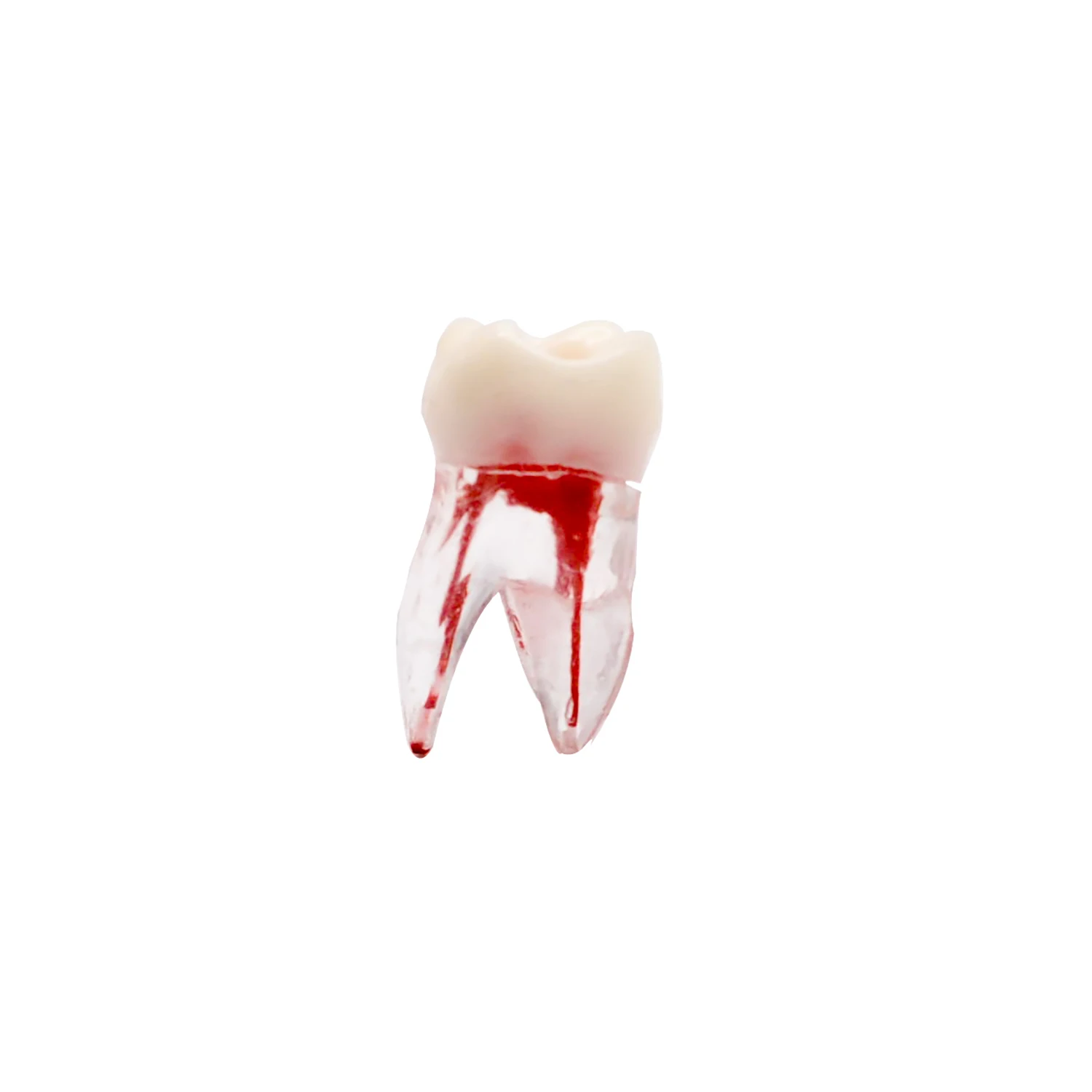 Dental-Root-Canal-Teeth-Model-Surgery-Resin-Endodontic-Practice ...