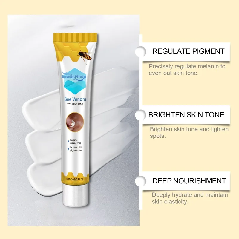 Bee Venom Vitiligo Treatment Cream Eliminate Vitiligo Sweat Spot Antibacterial Mycosis Leukoplakia Cure Moisturizes Care Cream vitiligo ointment
