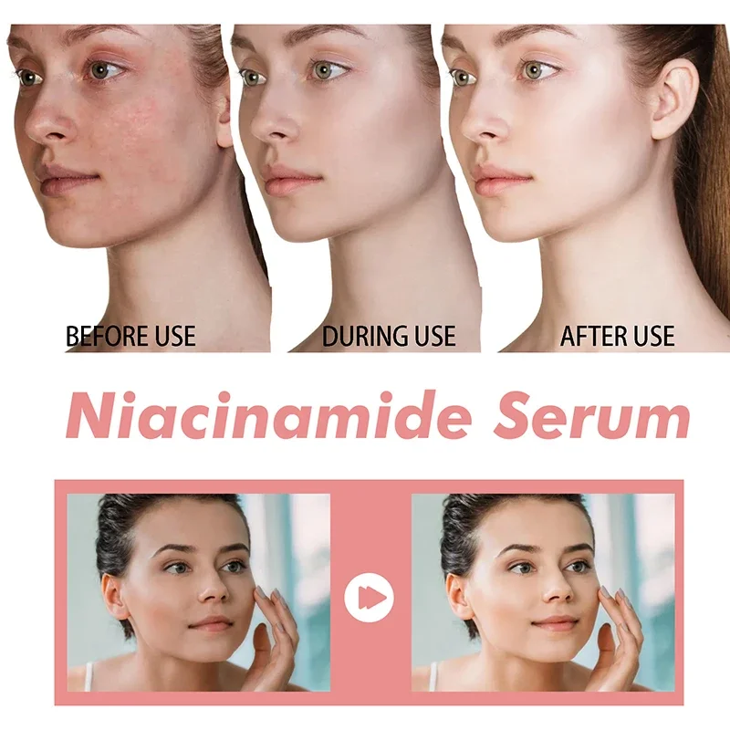 30ml Peach 70% Niacinamide Serum Moisturizing Prevent Dryness Facial Essential Oil Increasing Elasticity Smooth Soften Skin Care 2