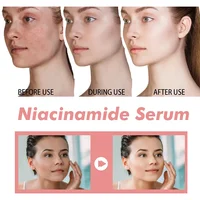 30ml Peach 70% Niacinamide Serum Moisturizing Prevent Dryness Facial Essential Oil Increasing Elasticity Smooth Soften Skin Care 2