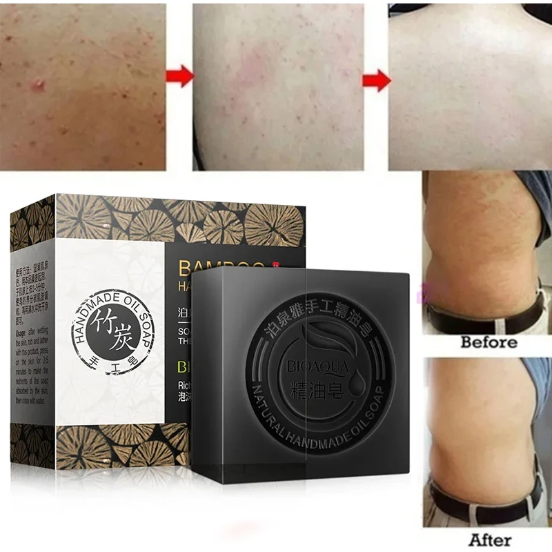 Bamboo Charcoal Handmade Soap Skin Moisturizing Deep Cleansing Oil Control Blackhead Remover Face Wash Hair Bath Skin Care 100g