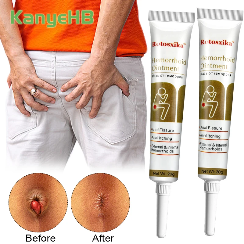 2Pcs Hemorrhoids Ointment Internal Piles External Anal Fissure Cream Relief Anal Pain Swelling Itch Chinese Medicine Cream A1956