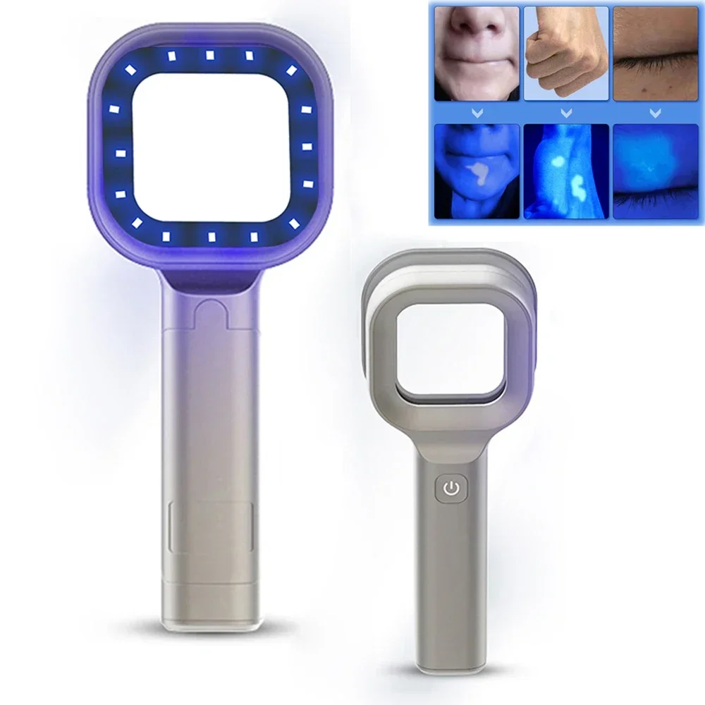 Woods Lamp Skin Analyzer Portable Facial Salon Beauty Analyzer UV Lamp Wood Dermatology for Analyzing Testing Examination