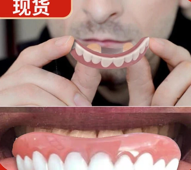 Fausses dents en Silicone, couverture supérieure et inférieure, facettes  dentaires, dentier, dentier, dentier, blanchir - AliExpress