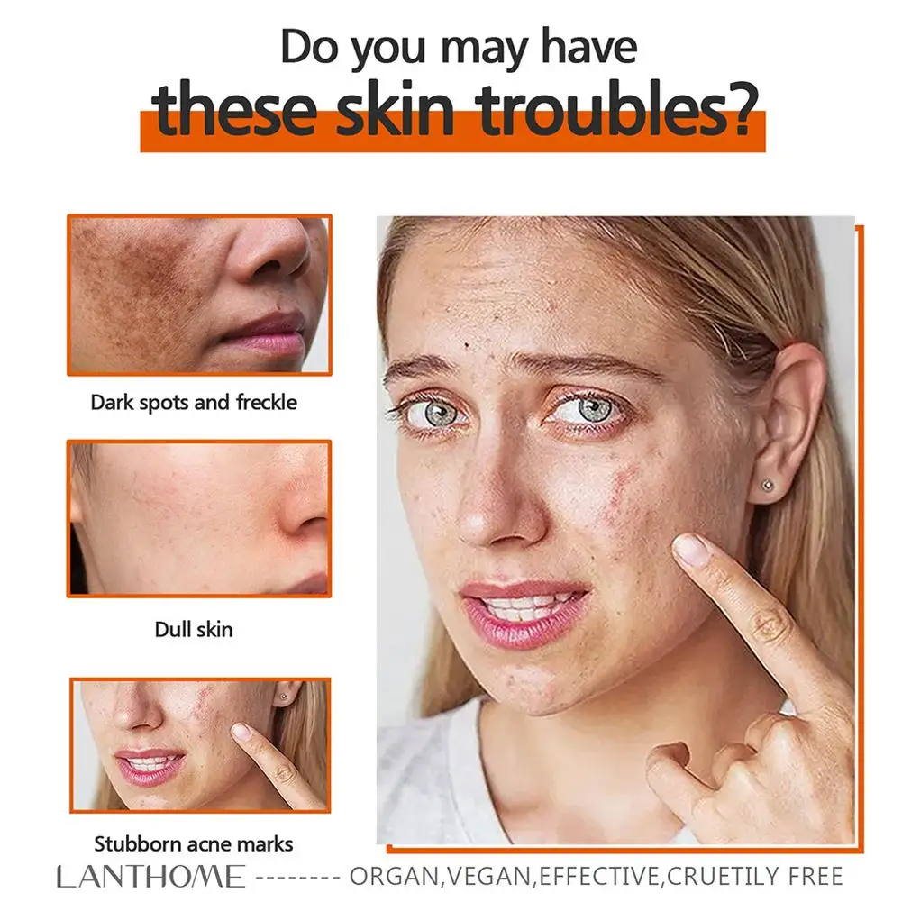 Рисунок 6 - Отбеливающее мыло ручной работы