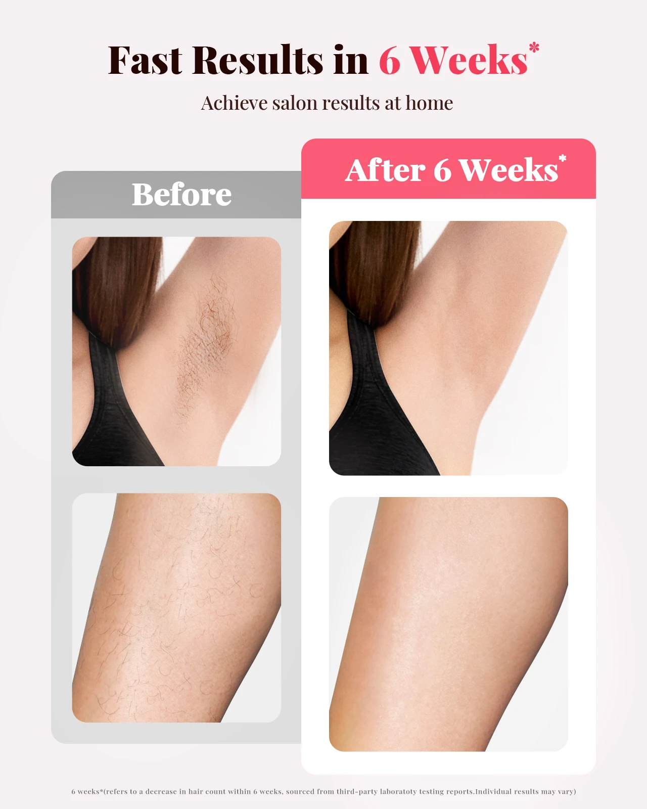 Permanent Laser Epilator Unlimited Flashes 9 Levels IPL Hair Removal Laser 2 Modes Women's Bikinis Facial Treament For Home Use