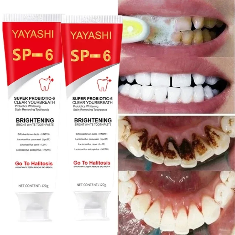 

SP-6 Whitening Tooth Remove Plaque Stains Probiotic Toothpaste Teeth Whitener Oral Hygiene Clean Fresh Breath Denta 120g