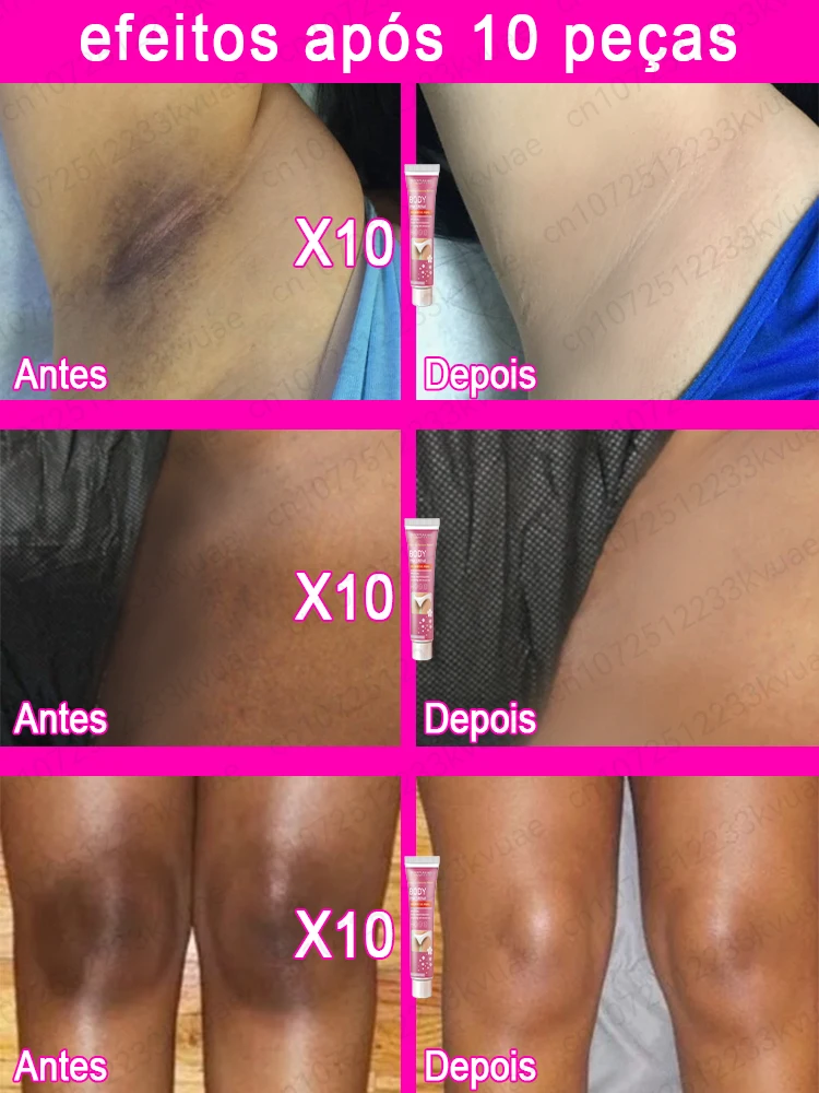 Whitening Cream Private Parts Underarm Bleaching Serum Whiten Butt Knee Brighten Inner Thigh Intimate Parts Dark Remove Melanin
