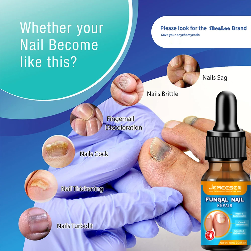 Jemeesen Fungus Removal Serum Gel Anti Infection Paronychia Onychomycos Nail Fungal Treatment Feet Care Essence Repair Nail Oil For Nail Fungus Remover