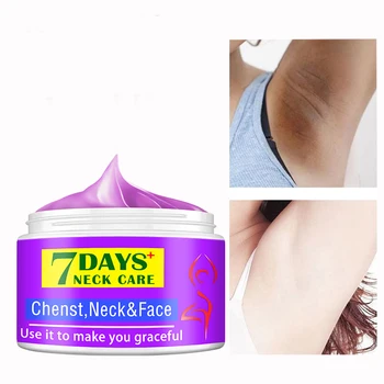 7days Body Whitening Cream Underarm Armpit Knee Dark Spot Cream Skin Brighten Moisturizing Body Care Cosmetics for Women Men 5
