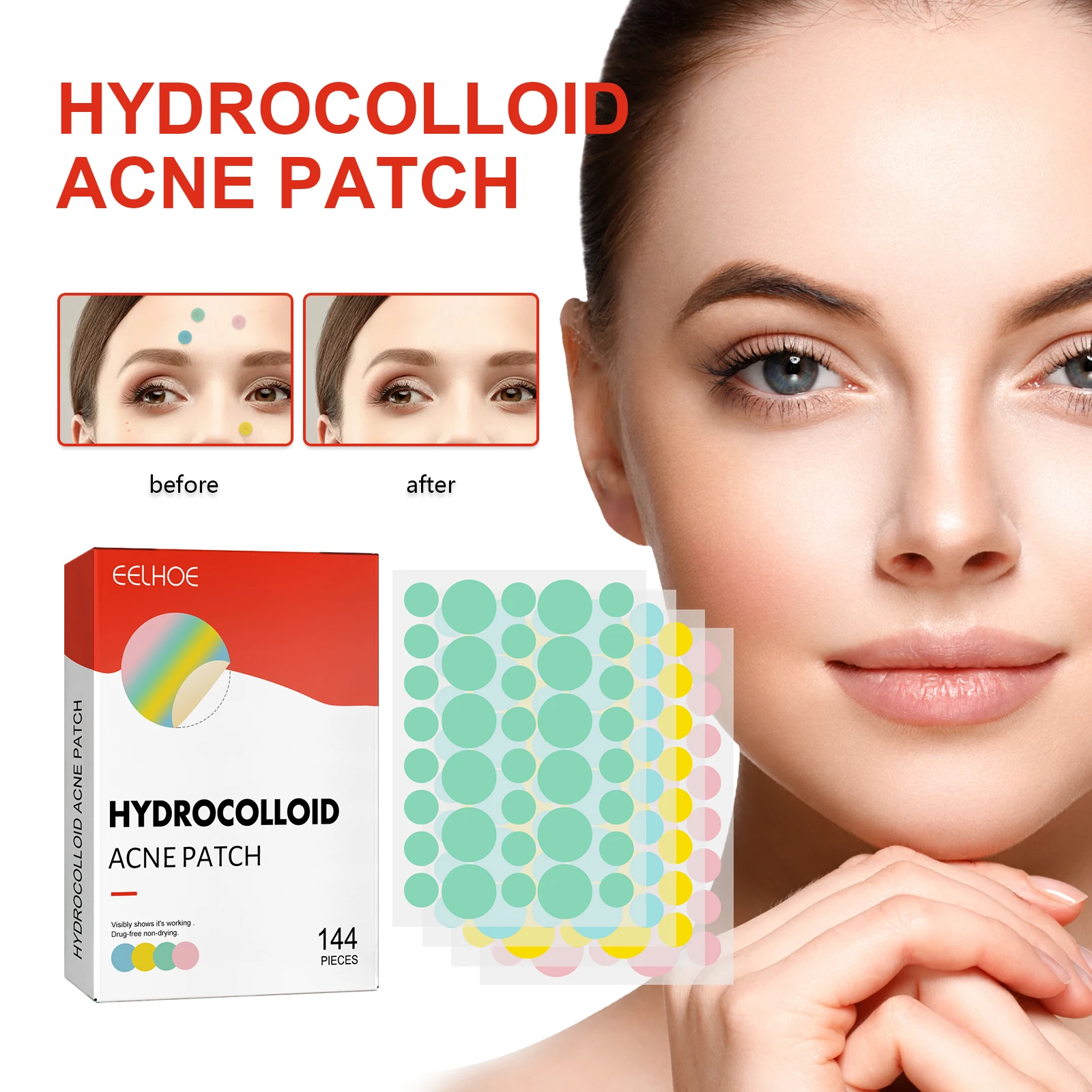 Colorful Acne Patch Acne Gel Stickers Clean Pores Remove Oil Gentle And Non Irritating Improve Acne Skin Face Care Product