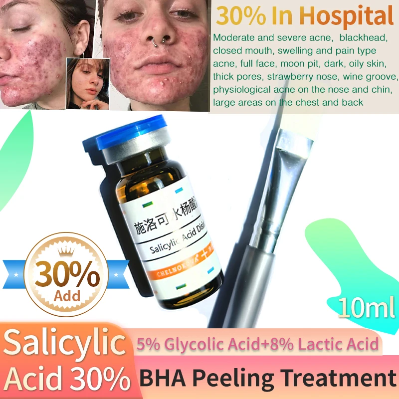 Bha Salicylic Scid 30 High Concentration Strong Power Peeling Strawberry Nose Papule Agria