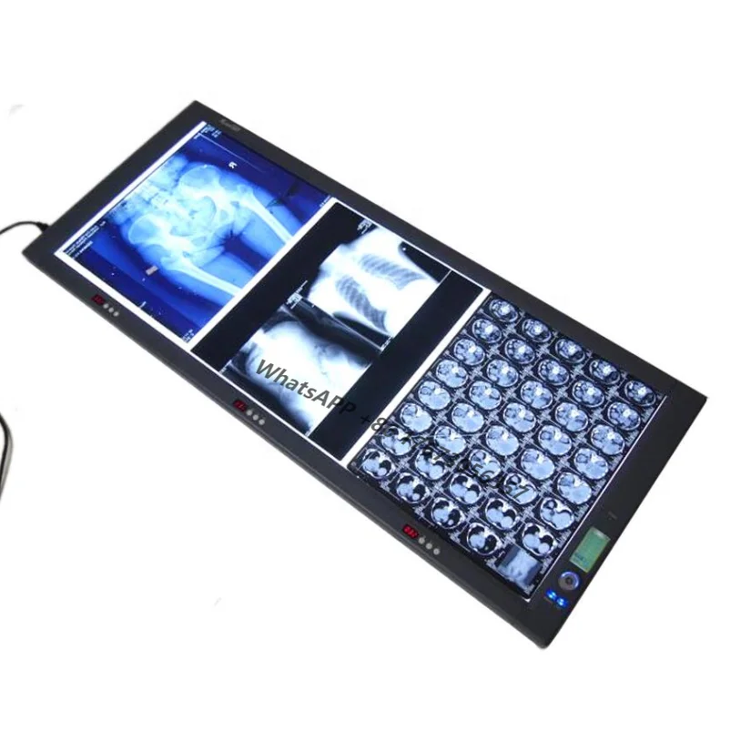 

X-ray LED Triple Film Viewer Radiographic Film Viewer Medical led Negatoscope