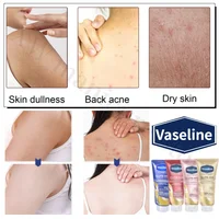Vaseline Glutamine Whitening Body Lotion Highly Concentrated Niacinamide Hyaluronic Acid Brightens Skin Deeply Hydrating 330ml 4