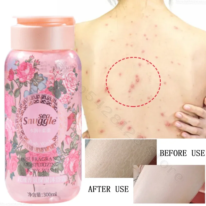 300ml Rose Fragrance Moisturizing Shower Gel To Improve Dry Skin, Whitening, Hydrating and Fragrant, Removing Mites and Mites