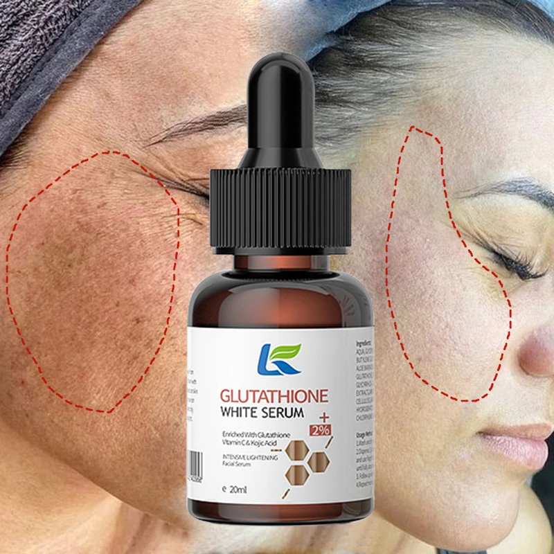 Whitening Serum Fade Dark Spot Freckle Brighten Essence Remove Pigment Melanin Correcting Beauty Face Skin Care