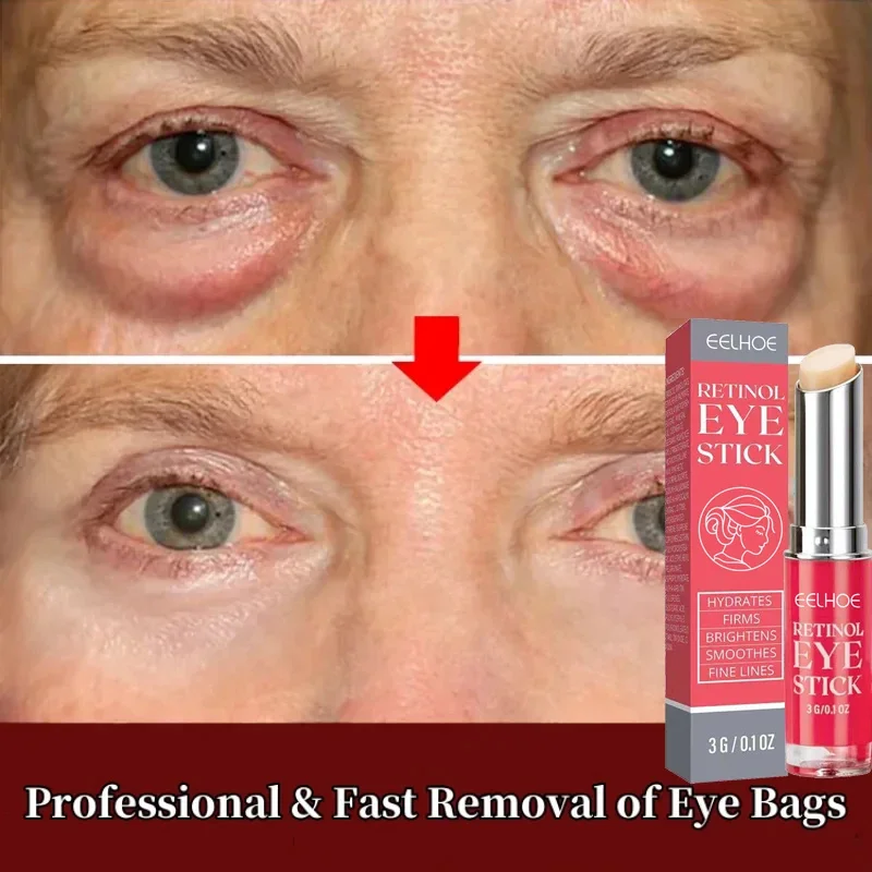 

Instant Eye Bag Remove Eye Cream Retinol Anti-Wrinkle Remove Fat Particles Dark Circles Anti Aging Lifting Brighten Eye Care