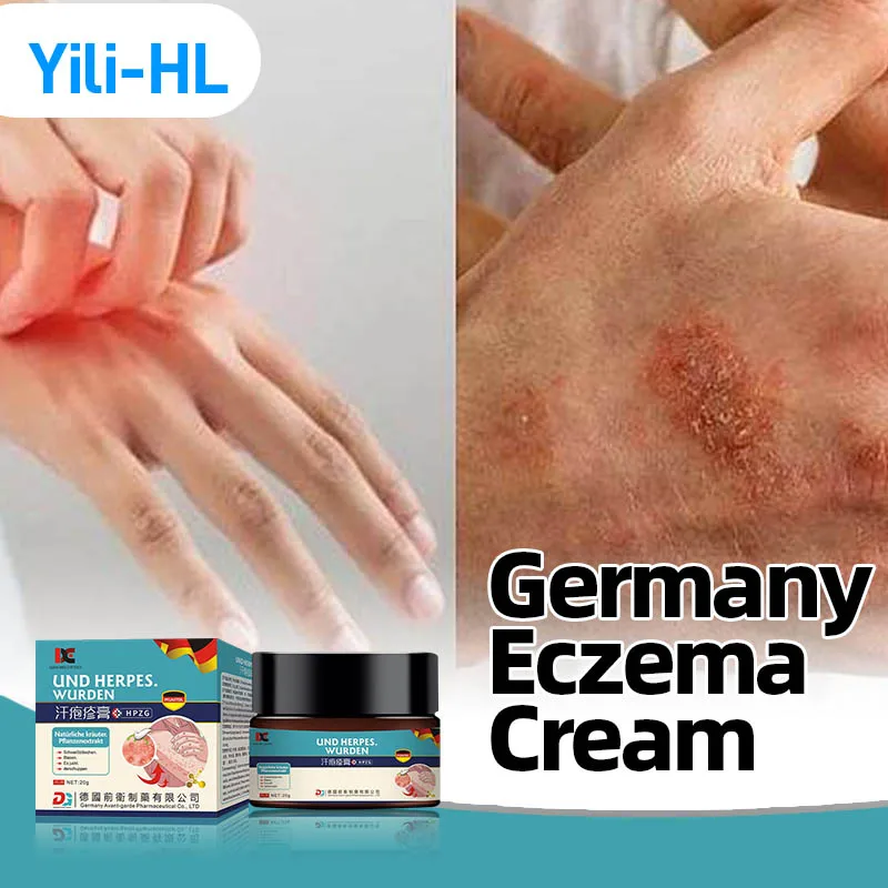 

Germany Eczema Treatment Cream Psoriasis Fungus Ointment Dermatitis Eczematoid Antibacterial Anti-itch Pompholyx Herbal Medicine