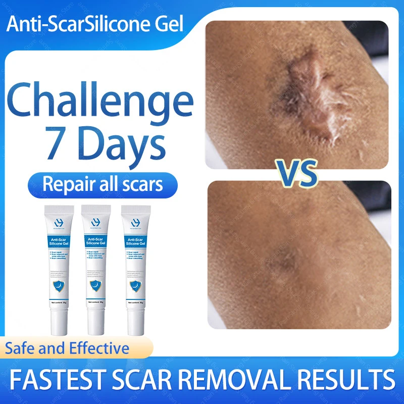 

Scar removal cream hyperplastic scars burn cae sarean section surgical scars