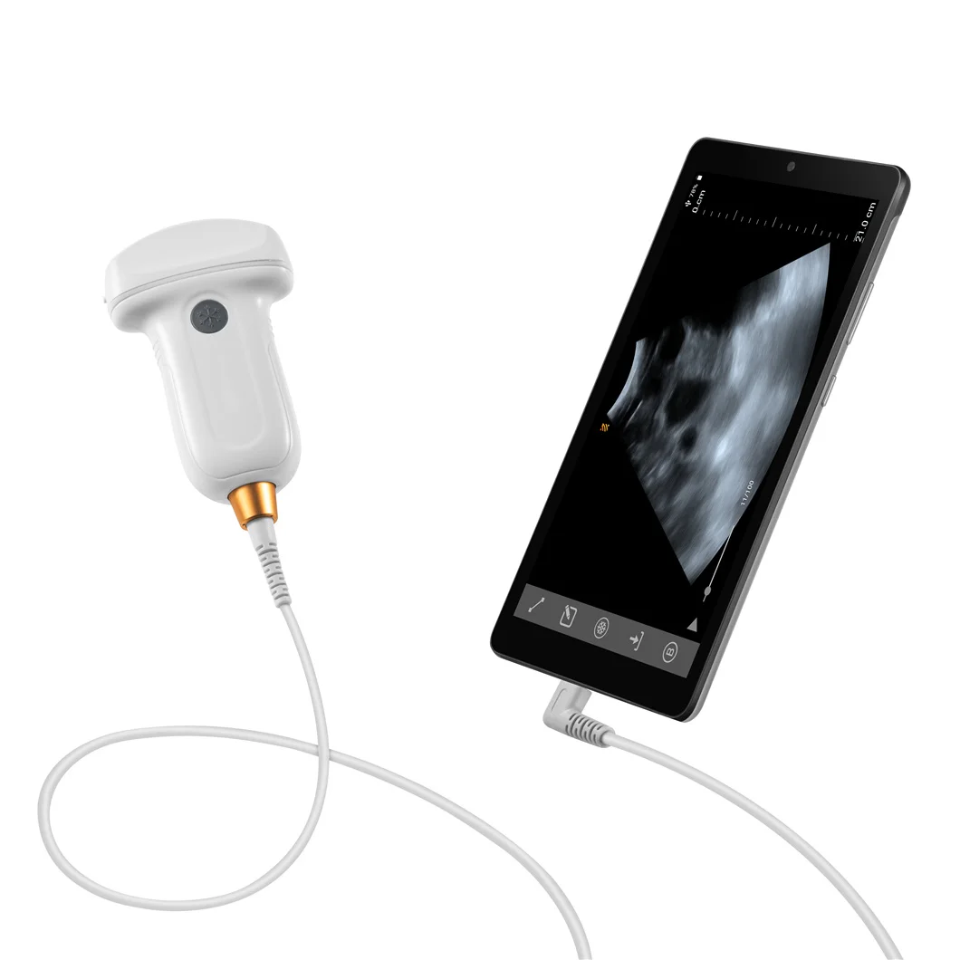 

Higher sensitivity economic hot sale portable handheld type C USB equine veterinary ultrasound probe for Android
