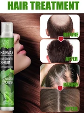  10ml Hair Growth Spray Fast Grow Hair Oil Hair Loss Cure For Thinning Hair Growth Spray Products Hair Care For Men Women New 