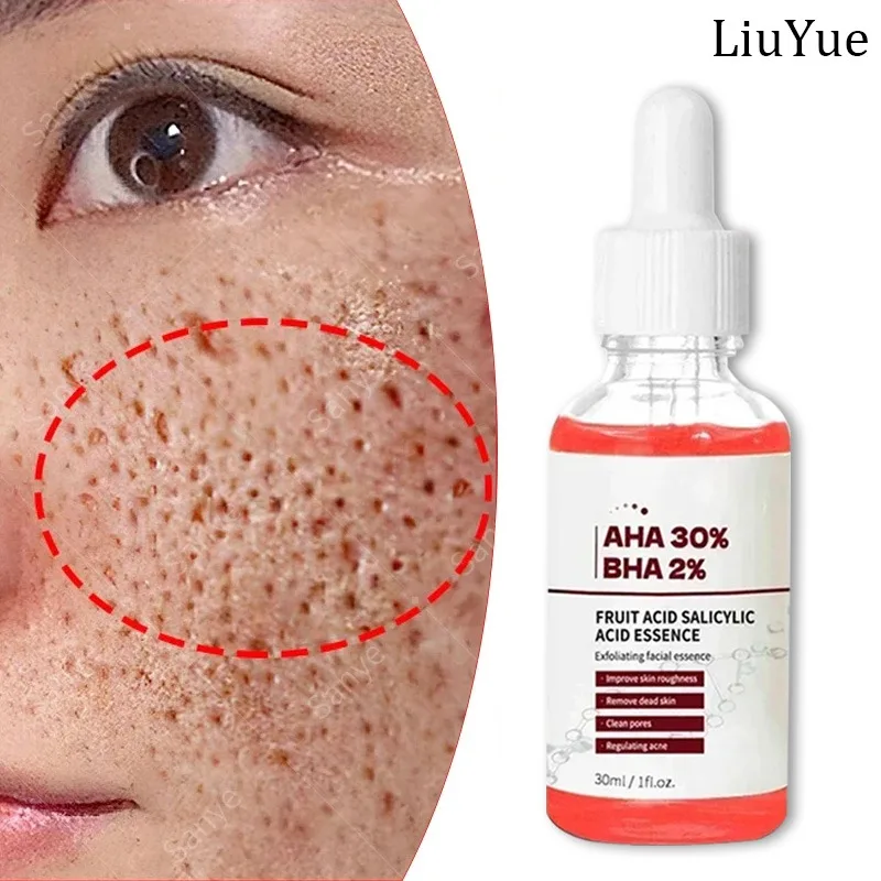 

Remove Acne Whitening Serum Powerful Tighten Pores Essence Face Pore Shrinking Serum Salicylic Acid Oil Control Firming Products