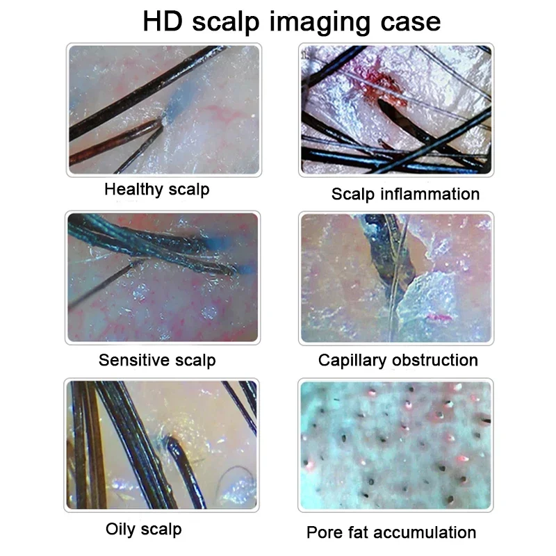 Analizzatore digitale HD della pelle Rilevatore professionale della fotocamera del cuoio capelluto dei capelli Dispositivo per test dell'umidità dell'olio dei follicoli piliferi 15 pollici - immagine 3