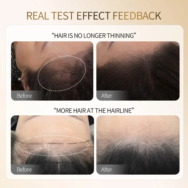 Borala Tattoo Hairline Pigment for Beauty Health Hair Growth Paint Hair Scalp Treatment Anti Loss Products Semi Permanent Tattoo
